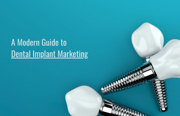 Dental Implant Marketing